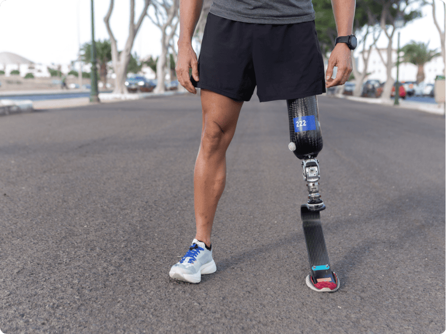 amputation prothèse jambe